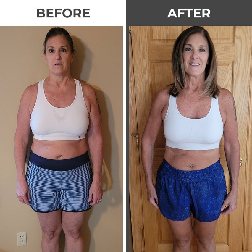 Before & After - Lori