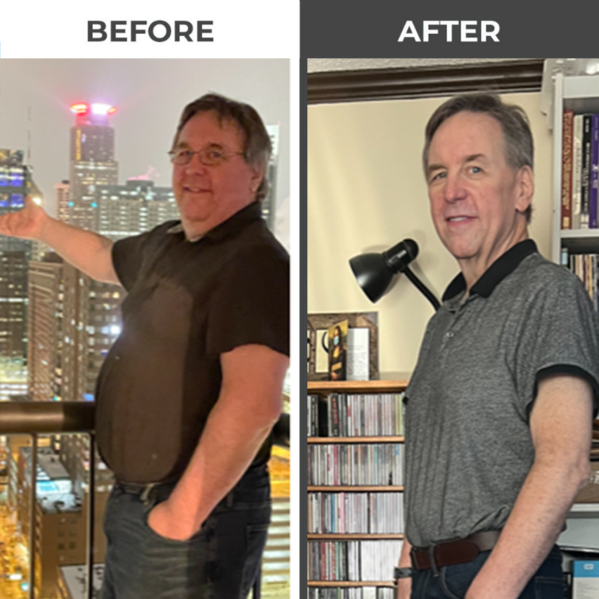 Before & After - Jay